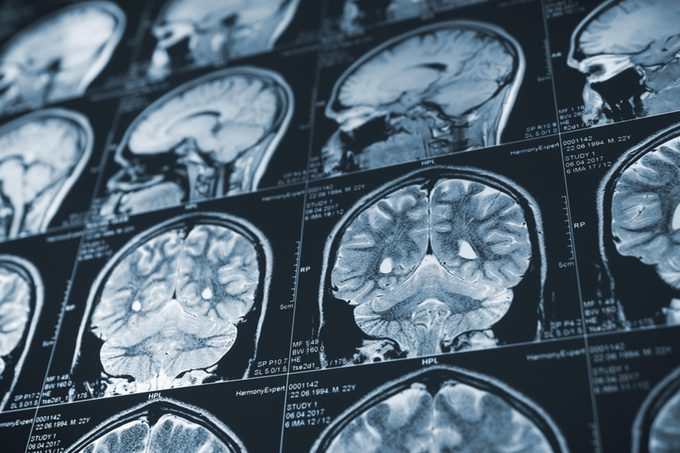 38 Habits to Start Today to Keep Your Brain Healthy at 80